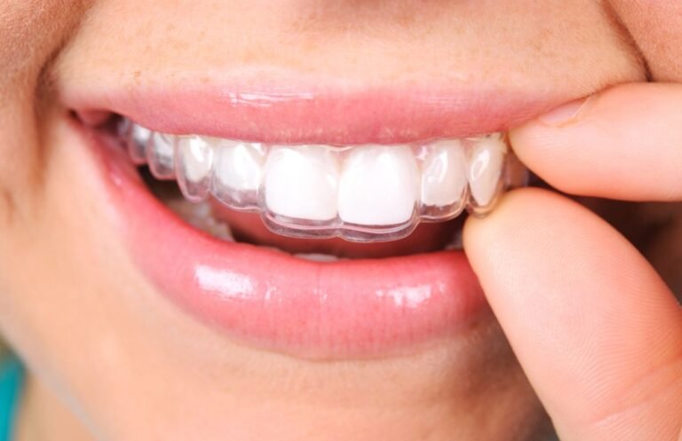why do I need to wear a retainer